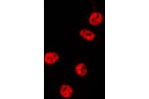 ABIN6275508 staining MCF7 by IF/ICC. (RCL1 antibody  (C-Term))