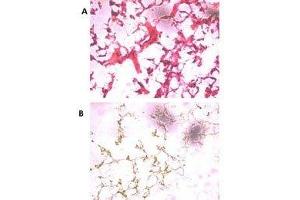 (A) H&E staining of frozen human ovarian cancer tissue with UCH37 antibody at 1:250. (UCHL5 antibody  (AA 56-87))
