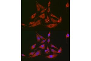 Immunofluorescence analysis of BALB-3T3 cells using GOT2 antibody (ABIN6131312, ABIN6141285, ABIN6141286 and ABIN6222651) at dilution of 1:100 (40x lens). (GOT2 antibody  (AA 30-200))