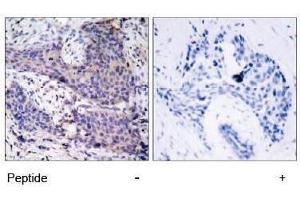 Image no. 1 for anti-BCL2-Associated Agonist of Cell Death (BAD) (Ser136) antibody (ABIN197210) (BAD antibody  (Ser136))