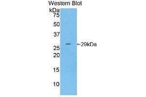Western Blotting (WB) image for anti-Integrin alpha D (ITGAD) (AA 879-1099) antibody (ABIN3208930) (ITGAD antibody  (AA 879-1099))