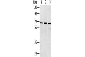Gel: 8 % SDS-PAGE, Lysate: 40 μg, Lane 1-3: 293T cells, hepg2 cells, A172 cells, Primary antibody: ABIN7192509(SLC5A9 Antibody) at dilution 1/300, Secondary antibody: Goat anti rabbit IgG at 1/8000 dilution, Exposure time: 1 minute (SLC5A9 antibody)