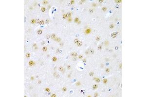 Immunohistochemistry of paraffin-embedded rat brain using TUSC2 antibody at dilution of 1:200 (40x lens). (TUSC2 antibody)