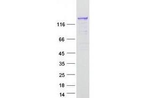 Validation with Western Blot (CIZ1 Protein (Transcript Variant 1) (Myc-DYKDDDDK Tag))