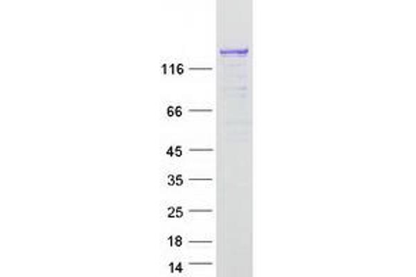 CIZ1 Protein (Transcript Variant 1) (Myc-DYKDDDDK Tag)