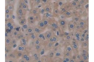 Detection of CNX in Mouse Liver Tissue using Polyclonal Antibody to Calnexin (CNX) (Calnexin antibody  (AA 263-482))