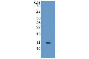 WB of Protein Standard: different control antibodies  against Highly purified E. (IL-33 ELISA Kit)
