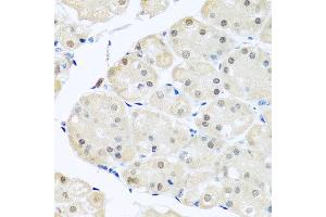 Immunohistochemistry of paraffin-embedded human stomach using DNAL1 antibody at dilution of 1:100 (x40 lens). (DNAL1 antibody)