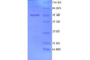 Golgi Membrane Protein 1 (GOLM1) (AA 36-401), (partial) protein (His tag) (GOLM1 Protein (AA 36-401, partial) (His tag))