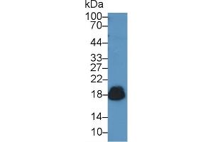 Detection of CD59 in Human Urine using Polyclonal Antibody to Cluster of Differentiation 59 (CD59) (CD59 antibody  (AA 23-105))
