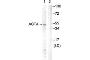 Western blot analysis of extracts from mouse brain cells, using Actin-pan ( alpha/gamma)  (Ab-55/53) Antibody. (Actin antibody  (AA 21-70))