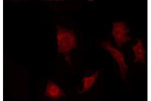 ABIN6272299 staining Hela by IF/ICC. (FGF22 antibody  (Internal Region))