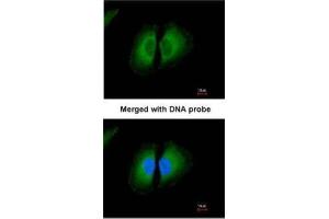 ICC/IF Image Immunofluorescence analysis of paraformaldehyde-fixed HeLa, using Kininogen-1, antibody at 1:200 dilution. (KNG1 antibody)