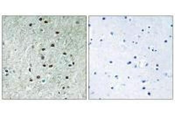 REXO1 antibody