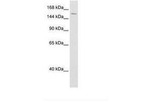 Image no. 2 for anti-ATP-Dependent RNA Helicase A (DHX9) (AA 171-220) antibody (ABIN6736602) (DHX9 antibody  (AA 171-220))