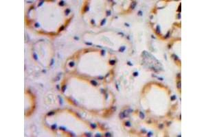 Used in DAB staining on fromalin fixed paraffin-embedded Kidney tissue (Cadherin 5 antibody  (AA 68-307))