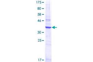 TCEB1 Protein (AA 1-112) (GST tag)