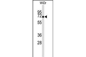 Western blot analysis of TOA Antibody (N-term) (ABIN652236 and ABIN2840990) in WiDr cell line lysates (35 μg/lane). (TOM70 antibody  (N-Term))