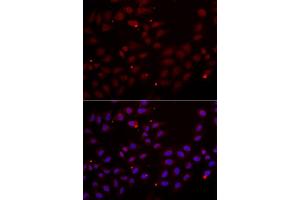 Immunofluorescence analysis of HeLa cells using CST2 antibody (ABIN5973947).