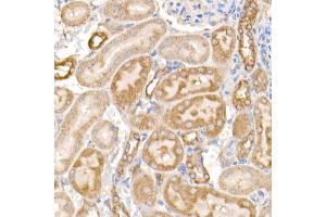 Immunohistochemistry of paraffin-embedded rat kidney using MMP14/MT1-MMP Rabbit pAb (ABIN3023354, ABIN3023355, ABIN3023356 and ABIN6219646) at dilution of 1:100 (40x lens). (MMP14 antibody)