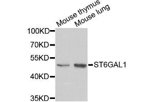 Western blot analysis of extracts of various cell lines, using ST6GAL1 antibody (ABIN5973377) at 1/1000 dilution. (ST6GAL1 antibody)