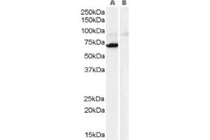 Image no. 1 for anti-Monoamine Oxidase A (MAOA) (Internal Region) antibody (ABIN374605) (Monoamine Oxidase A antibody  (Internal Region))