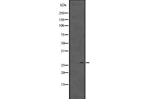 Western blot analysis of C10orf63 using 293 whole cell lysates (ENKUR antibody  (Internal Region))