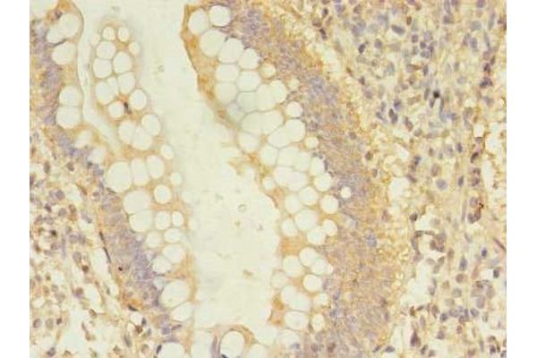 Dynamitin antibody  (AA 1-252)