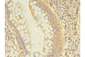 Immunohistochemistry of paraffin-embedded human small intestine tissue using ABIN7150805 at dilution of 1:100 (Dynamitin antibody  (AA 1-252))