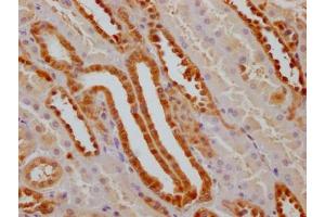 IHC image of ABIN7127532 diluted at 1:100 and staining in paraffin-embedded human kidney tissue performed on a Leica BondTM system. (Recombinant GSTP1 antibody)