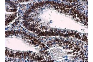 Immunohistochemistry (IHC) image for anti-Nuclear Mitotic Apparatus Protein 1 (NUMA1) (N-Term) antibody (ABIN2856910)