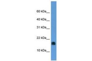 Image no. 1 for anti-Microsomal Glutathione S-Transferase 1 (MGST1) (AA 46-95) antibody (ABIN6746808) (MGST1 antibody  (AA 46-95))