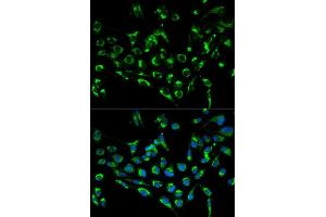 Immunofluorescence analysis of MCF7 cell using CDKN3 antibody. (CDKN3 antibody  (AA 1-172))