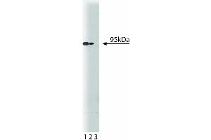 Western blot analysis of CD220 on a mouse liver lysate. (Insulin Receptor antibody  (AA 1006-1144))