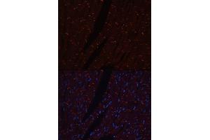 Immunofluorescence (IF) image for anti-Cadherin 2 (CDH2) (AA 750-850) antibody (ABIN3017243)