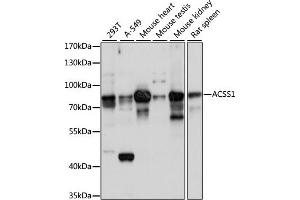 ACSS1 antibody  (AA 340-689)