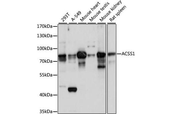 ACSS1 antibody  (AA 340-689)