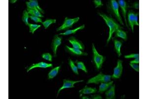 Immunofluorescence staining of Hela Cells with ABIN7127560 at 1:50, counter-stained with DAPI. (Recombinant ID1 antibody)