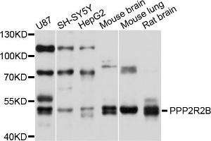 Western blot analysis of extracts of various cells, using PPP2R2B antibody. (PPP2R2B antibody)