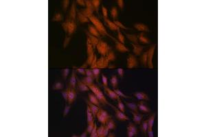Immunofluorescence analysis of C6 cells using Gli3 Rabbit mAb (ABIN7267385) at dilution of 1:100 (40x lens). (GLI3 antibody)