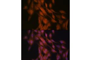 Immunofluorescence analysis of C6 cells using Gli3 Rabbit mAb (ABIN7267385) at dilution of 1:100 (40x lens). (GLI3 antibody)