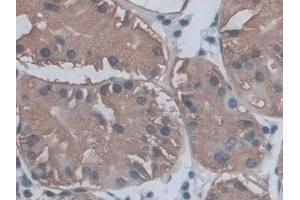 Immunohistochemistry (IHC) image for anti-CD209 (CD209) (AA 70-404) antibody (ABIN7444307)