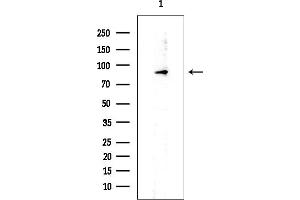 anti-DEAD (Asp-Glu-Ala-Asp) Box Polypeptide 21 (DDX21) (Internal Region) antibody