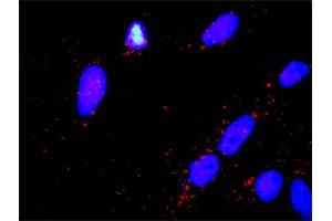Proximity Ligation Assay (PLA) image for anti-Parkinson Protein 2, E3 Ubiquitin Protein Ligase (Parkin) (PARK2) (AA 1-387) antibody (ABIN518619)