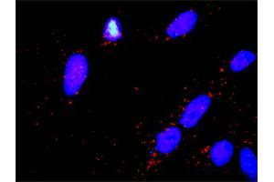 Proximity Ligation Analysis of protein-protein interactions between PARK2 and DLG1. (Parkin antibody  (AA 1-387))