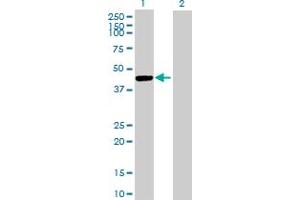 Western Blot analysis of CTSE expression in transfected 293T cell line by CTSE MaxPab polyclonal antibody. (Cathepsin E antibody  (AA 18-396))