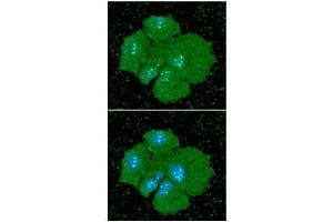ICC/IF analysis of PDPN in Hep3B cells line, stained with DAPI (Blue) for nucleus staining and monoclonal anti-human PDPN antibody (1:100) with goat anti-mouse IgG-Alexa fluor 488 conjugate (Green). (Podoplanin antibody  (AA 99-207))