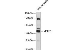 Western blot analysis of extracts of mouse brain, using MEF2C antibody (ABIN6132345, ABIN6143716, ABIN6143717 and ABIN6215998) at 1:3000 dilution. (MEF2C antibody  (AA 170-380))
