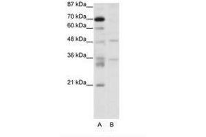 Image no. 1 for anti-Forkhead Box N2 (FOXN2) (C-Term) antibody (ABIN307420) (FOXN2 antibody  (C-Term))