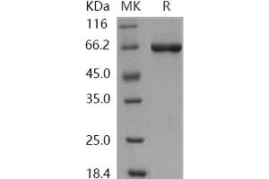 Western Blotting (WB) image for serine/threonine Kinase 40 (STK40) protein (GST tag,His tag) (ABIN7197936) (STK40 Protein (GST tag,His tag))